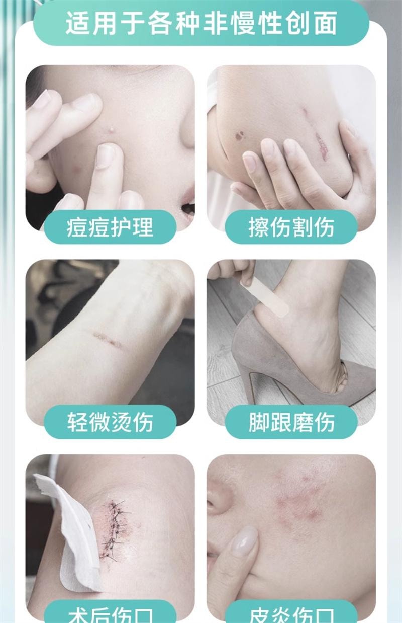 【中国直邮】 海氏海诺 医用水胶体敷料5片/盒 人工皮伤口愈合净痘人造皮肤贴大片痘痘贴