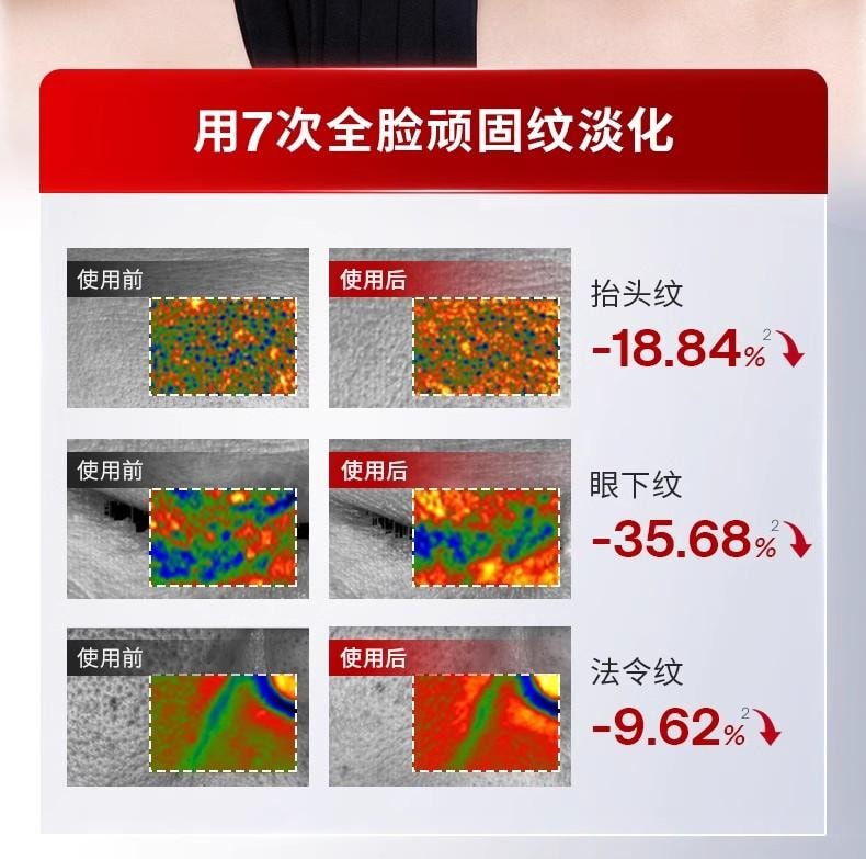 【母亲节到手价579】Jmoon极萌全新第三代旗舰代胶原炮MAX面部射频美容仪脸部提拉紧致仪器M30 Max
