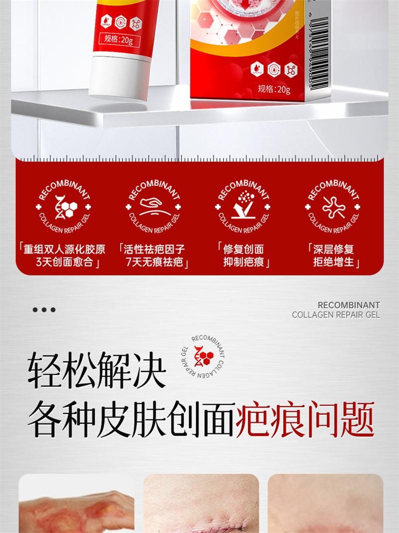 【中國直郵】 協和京品 祛疤膏疤痕修復除疤剖腹產手術疤兒童燙傷增生凸起去疤貼醫用重組膠原蛋白修復凝膠 20g