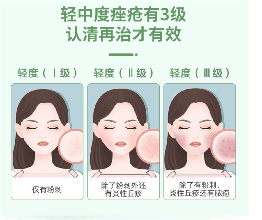 【中国直邮】仁和 阿达帕林凝胶 祛痘痘消炎维a酸乳膏 20g/支 (医师建议拍3盒)