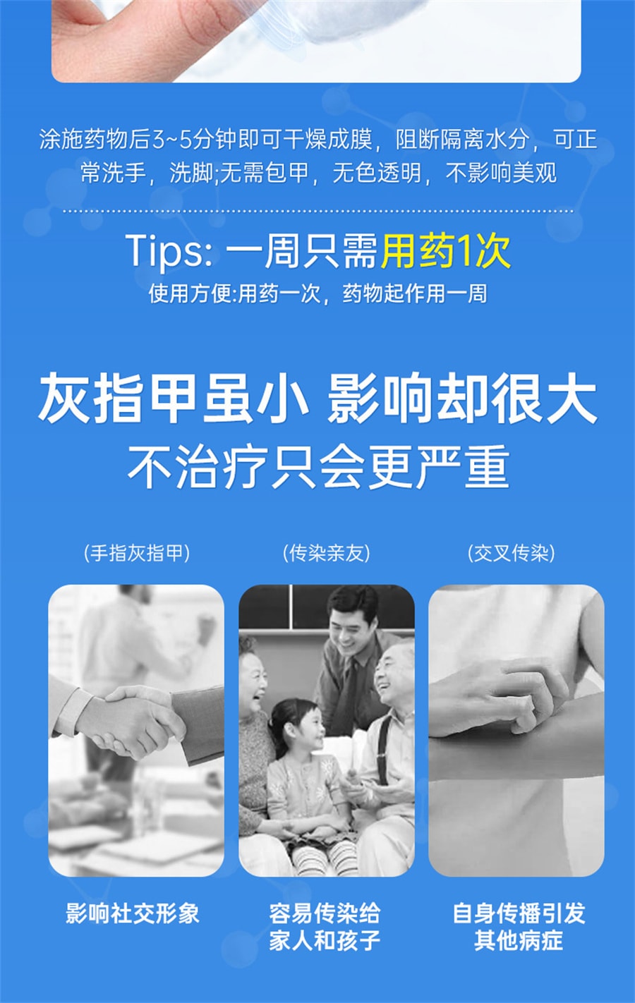 【中国直邮】楚甲 盐酸阿莫罗芬搽剂 灰指甲正品治疗脚气甲癣  1.5ml/盒