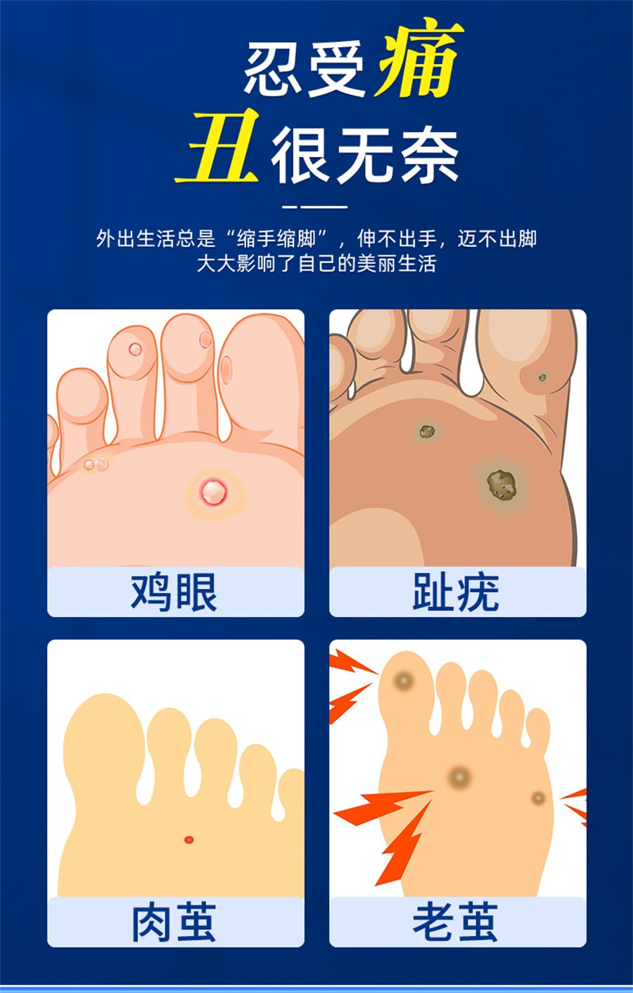 【中国直邮】北京同仁堂 鸡眼贴鸡贴眼鸡眼膏灵瘊子鸡尤平跖疣净康脚底 6贴/盒