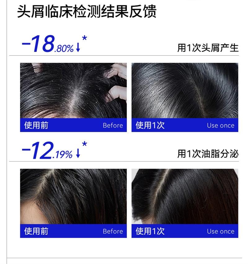 【中国直邮】 EHD 二硫化硒控油去屑洗发水 毛囊清洁蓬松洗头露膏男女 400ml