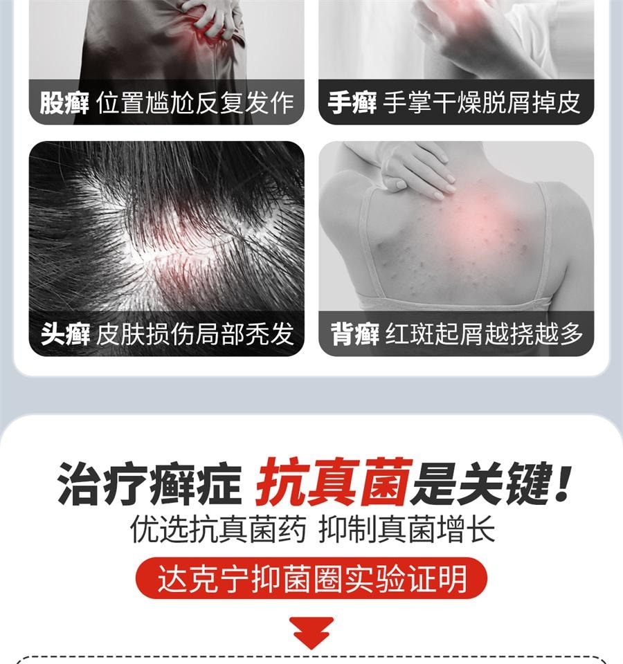  达克宁 酮康唑乳膏股癣专用药汗斑花斑癣药膏体癣手足癣花斑止痒 15g /支