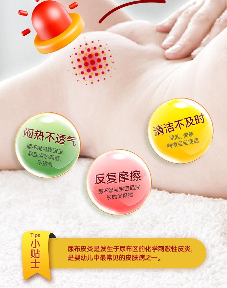 【中國直郵】 信龍 氧化鋅軟膏20g/盒嬰兒紅屁濕疹痱子皮膚炎止癢專用藥膏