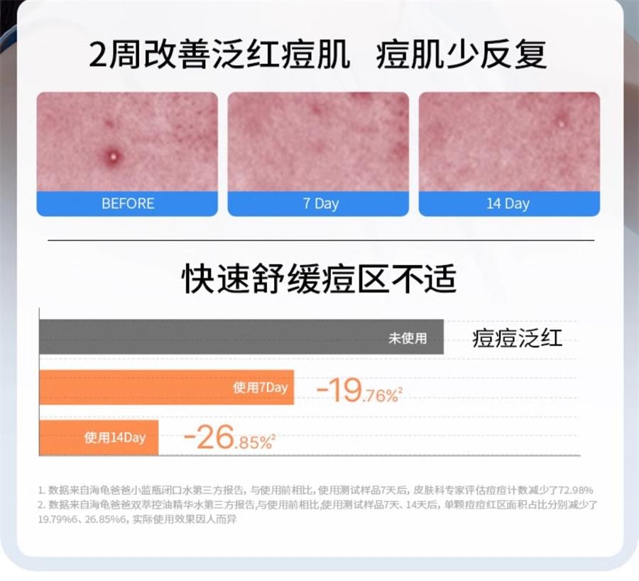 【中国直邮】 海龟爸爸 闭口水青少年控油抗痘爽肤水收缩毛孔精华水女孩湿敷水 150ml/瓶