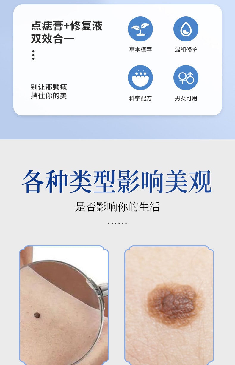 【中国直邮】广药白云山 点痣膏套装去尤祛黑痣丝状疣痦子瘊子脂肪粒点痣修复液套装 点痣膏+修护液 | 亚米