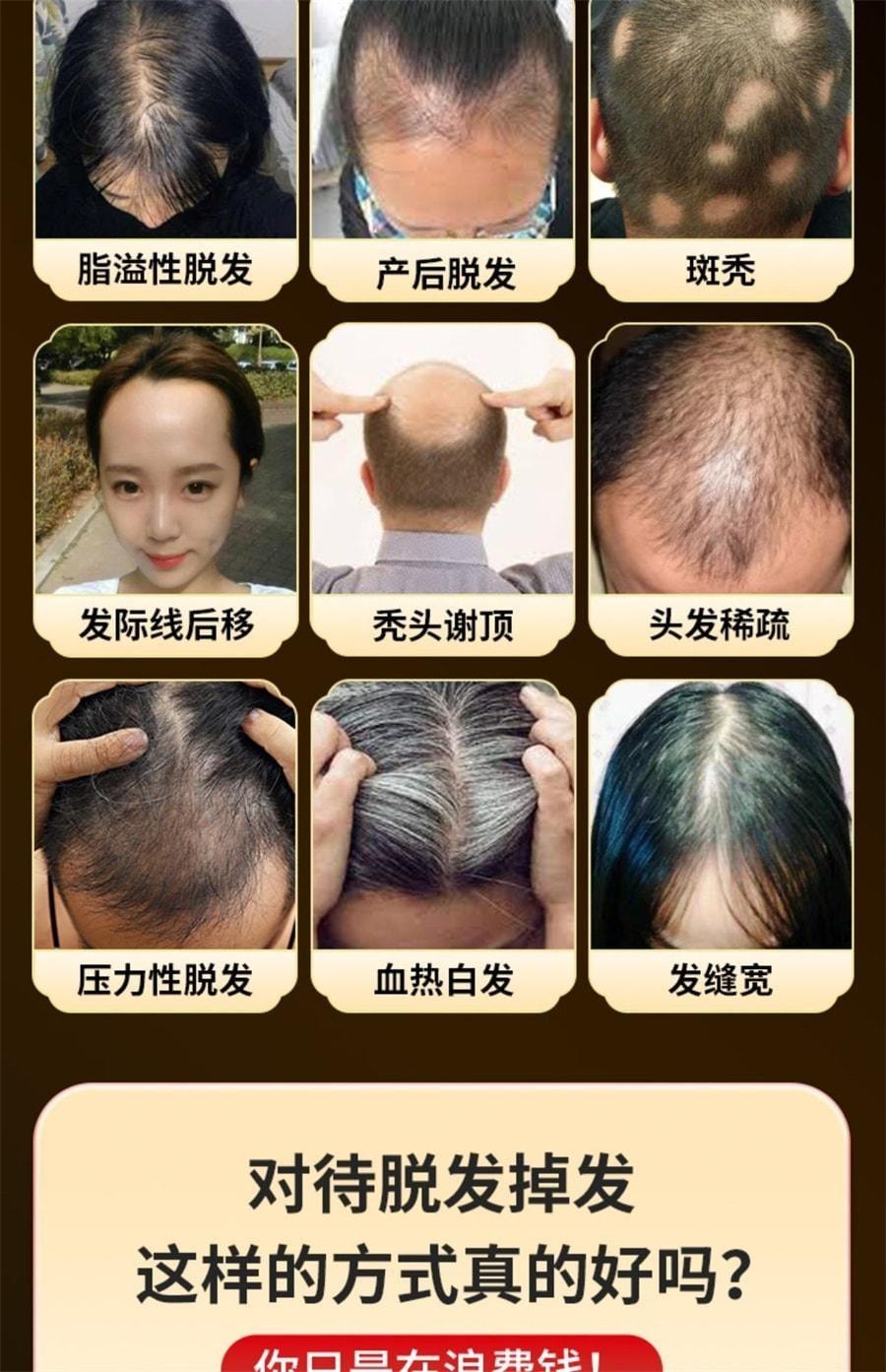 【中国直邮】 步长 荣发胶囊 改善掉发毛囊育发生发增发 防油脂溢性脱发斑秃补肝肾养气血 30粒/盒