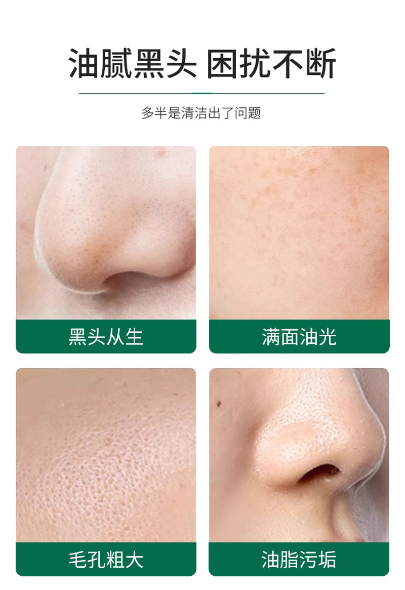 【中国直邮】稚漾 水杨酸焕肤绿泥膜黑泥膜清洁毛孔补水控油保湿高岭土涂抹面膜 5g/10粒