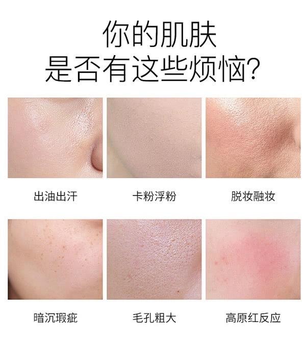 【香港直邮】 新西兰 萃乐活 有机认证玫瑰果精油 以油养肤  重塑屏障 45ml