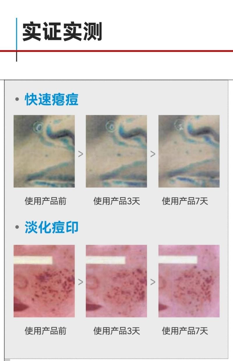 芙清 FulQun 修红祛痘次抛精华液 1.5ml*30支