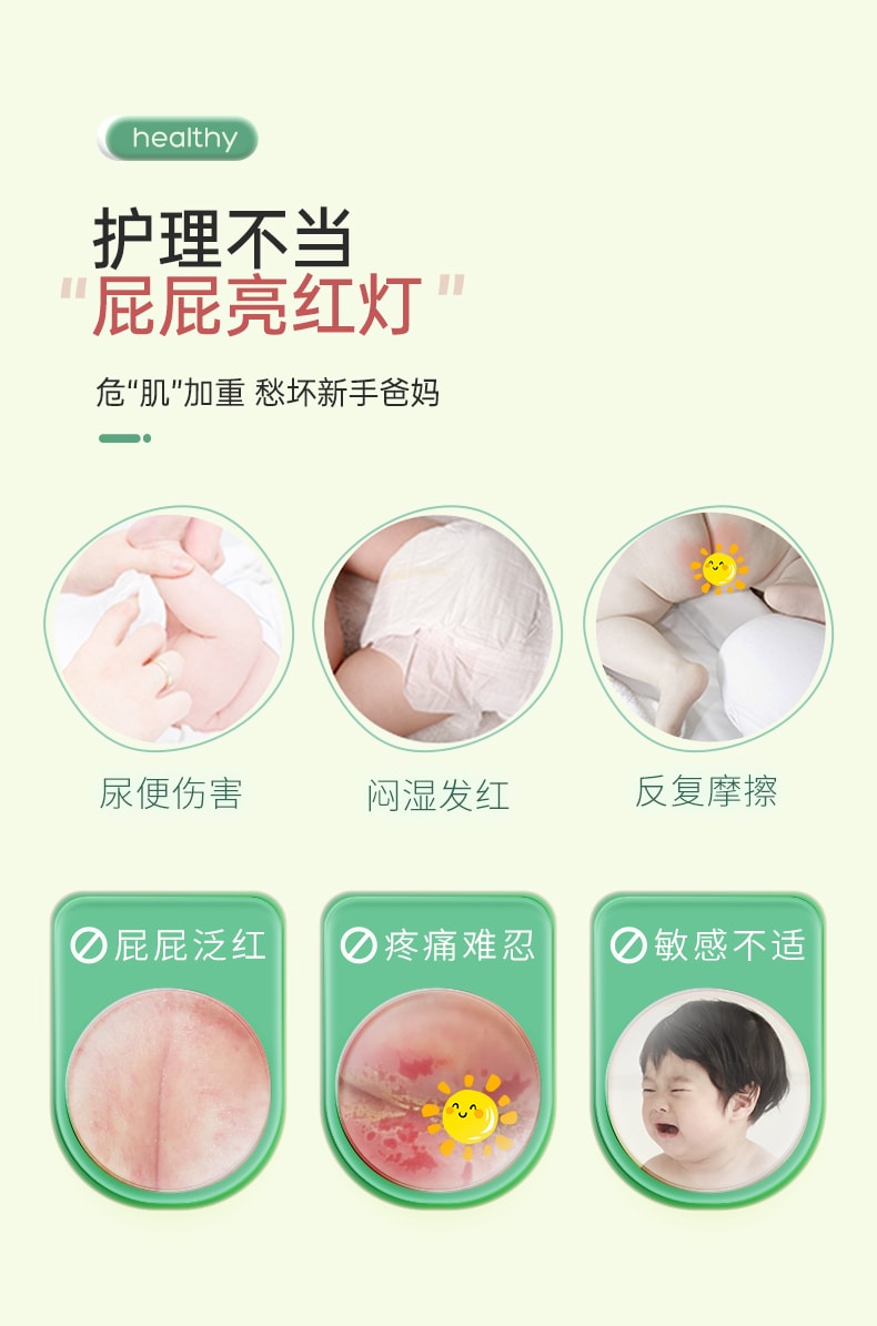 【中國直郵】鬆達 嬰兒 紅屁屁 山茶油護臀膏 21g