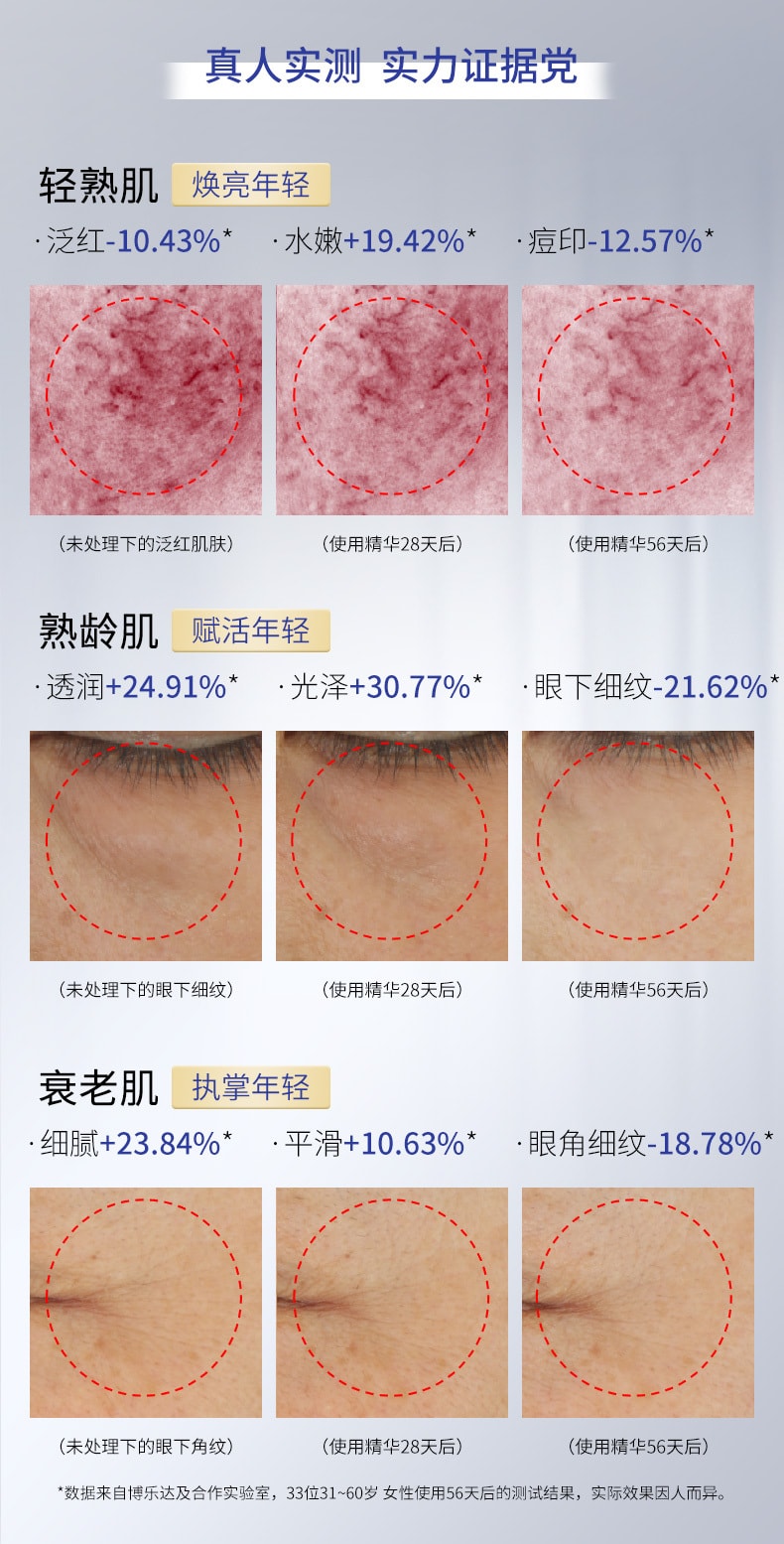 中国直邮 博乐达broda 专业线系列滋养修护精华超分子缓稀复合精华内含三七总皂苷美日欧盟多国发明专利