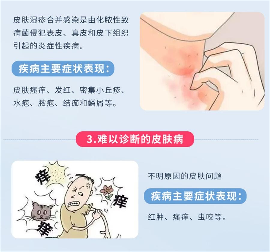 【中国直邮】 川石 复方克霉唑乳膏 用于脚气干裂止痒手藓真菌感染药膏20g/盒