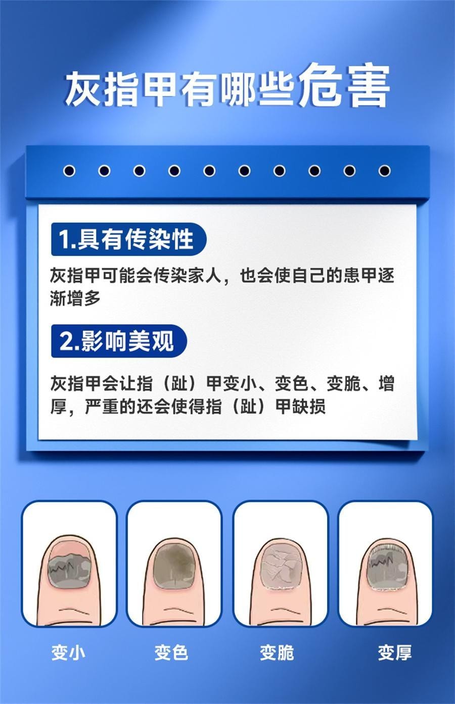 【中国直邮】 恒医森 环吡酮胺乳膏 治疗灰指甲专用药环比癣症真菌脚气止痒脱皮杀菌药水 20g/支