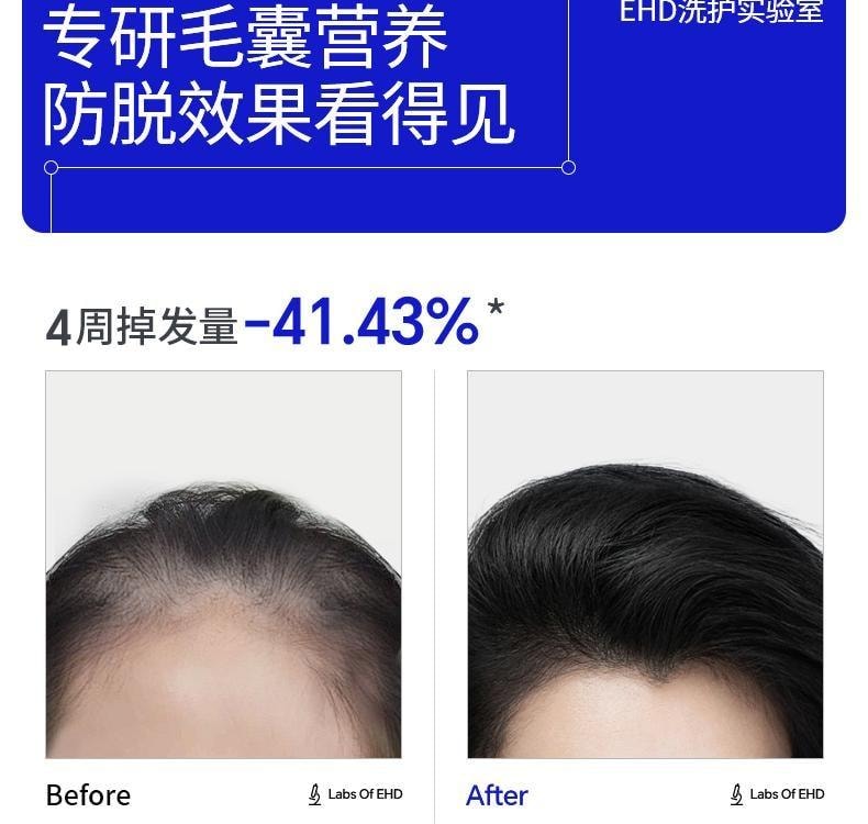【中国直邮】 EHD 防脱防断固发洗发水 高能修护发丝 固发丰盈强韧男女士洗头膏露 300ml/瓶