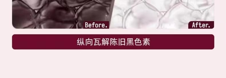中國 TZK 婷資可私處護理凝膠粉嫩去黑色素嫩紅精華素 1件