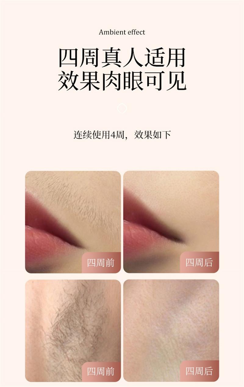 【中国直邮】 敏煌 冰点医用脱毛仪器全身腋毛腿毛私处 紫色