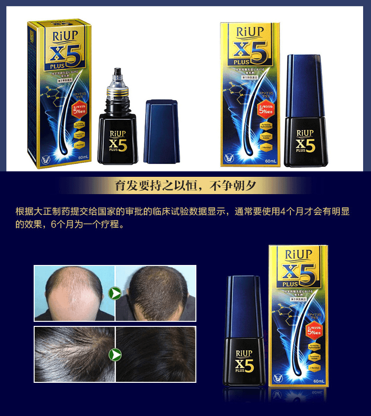 【日本直邮 】TAISHO 大正制药 男用防溢脂性脱发育发剂/RiUP X5增发液浓密头发60ml