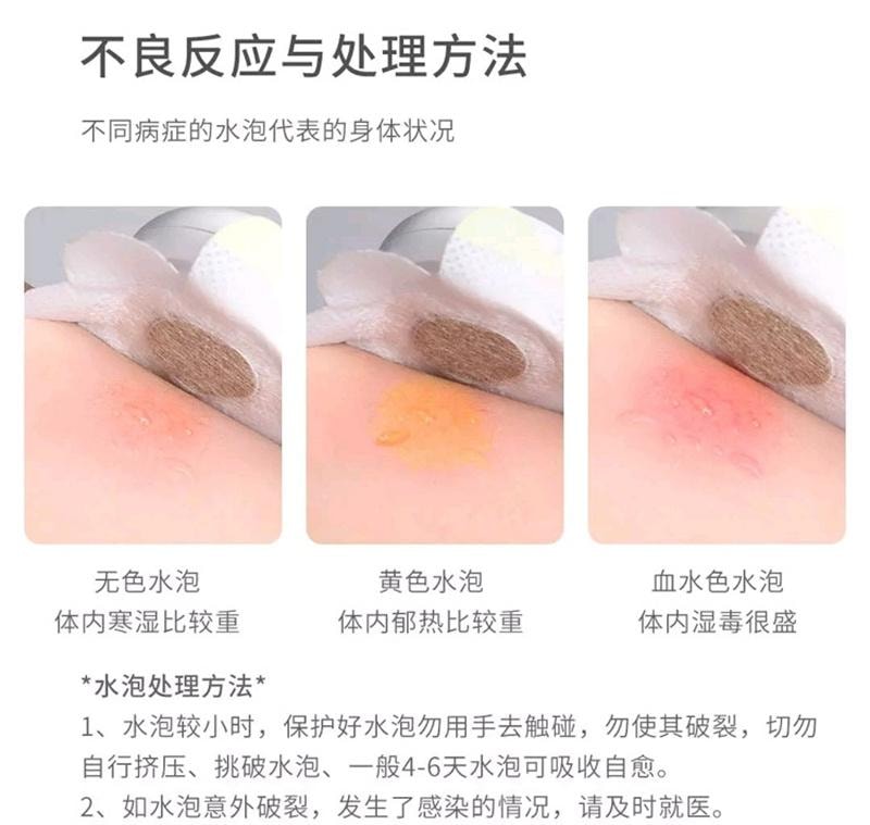 【中国直邮】 摩飞 艾灸盒随身灸家用全身无烟便携式盒子 1个装 含20片艾灸贴