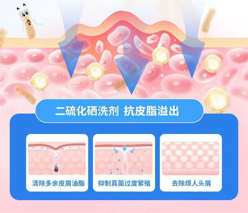 美国 希尔生 二硫化硒洗剂 脂溢性皮炎去头皮屑毛囊炎洗发水止痒花斑汗癣 50*1瓶/盒