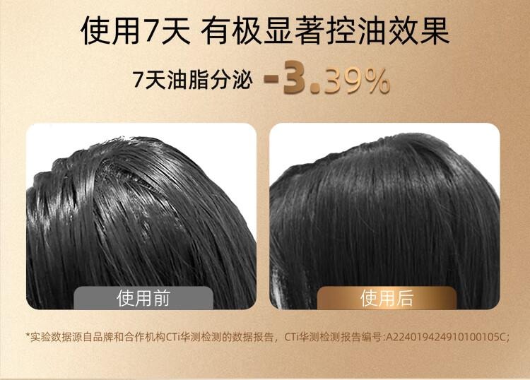 BREO倍轻松新升级Scalp3 头皮智能按摩梳 红光护发滋养护头皮头部按摩仪 IPX7防水 红色 生日节日礼物美国直邮【中国品牌】