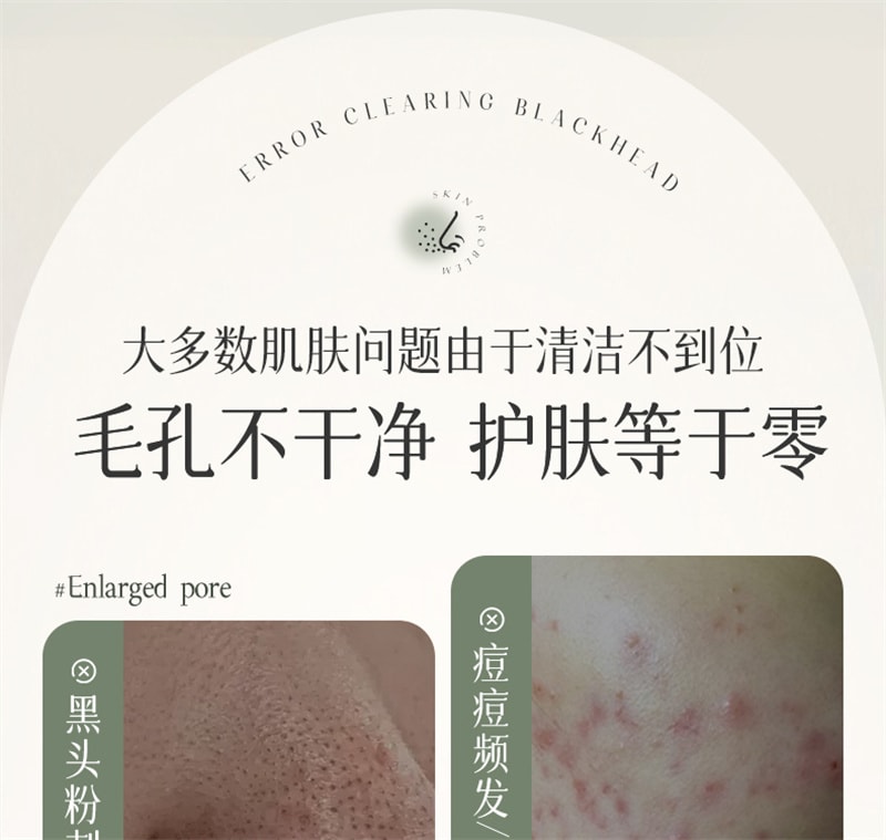 【中国直邮】 儒意 多酸净颜清肤泥膜 去黑白头闭口粉刺收缩深层清洁毛孔涂抹式积雪草清洁面膜 150g/瓶