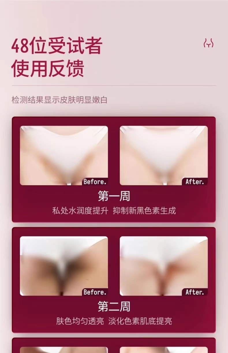 中國 TZK 婷資可私處護理凝膠粉嫩去黑色素嫩紅精華素 1件