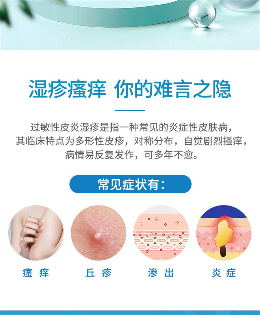 【中國直郵】 尤卓爾 丁酸氫化可的松乳膏 過敏性濕疹過敏性皮膚炎20g/支