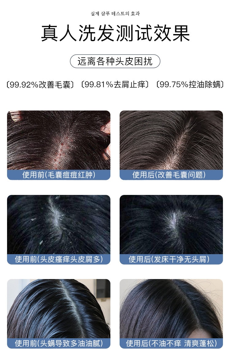 【中国直邮】南京同仁堂 毛炎宁 植萃祛痘去屑护理氨基酸洗发水500ml/瓶
