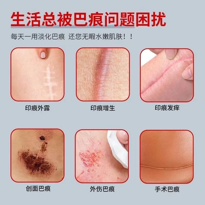 【中國直郵】 健醫師 醫用退燒凝膠 疤痕膏 燙傷燒傷術後增生創傷痘印巴痕凝膠型 20g/支