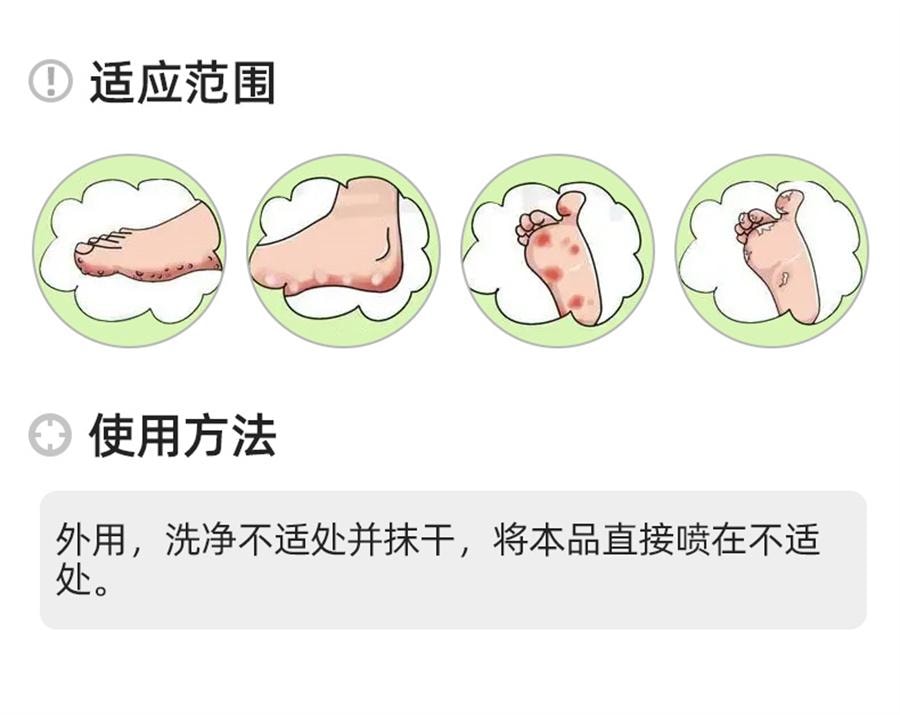 Wolf Poison Antibacterial Spray for Foot Itching Relief Foot Antibacterial Spray for Fungi 60ml per box