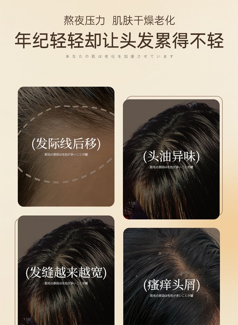 【中國直郵】側柏葉防脫洗髮精清潔滋養 增髮密髮控油去屑 500ml
