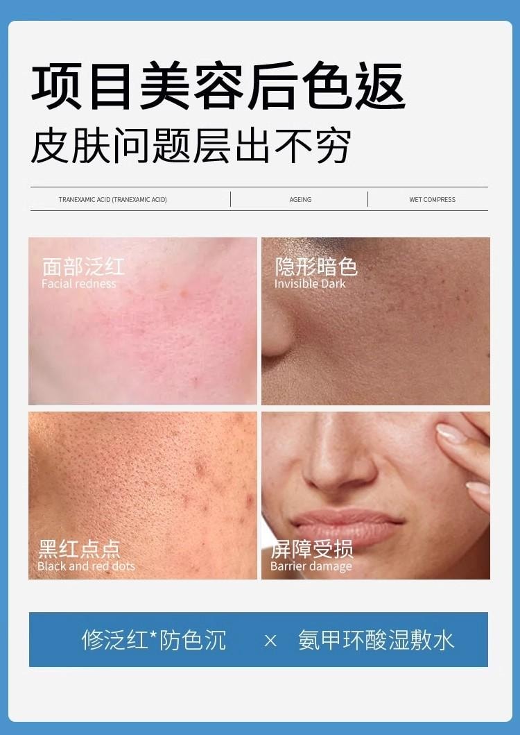 【中国直邮】 歌宝莲 氨甲环酸精华液 传明酸湿敷水去黄提亮褐斑补水修护舒缓 100ml/瓶