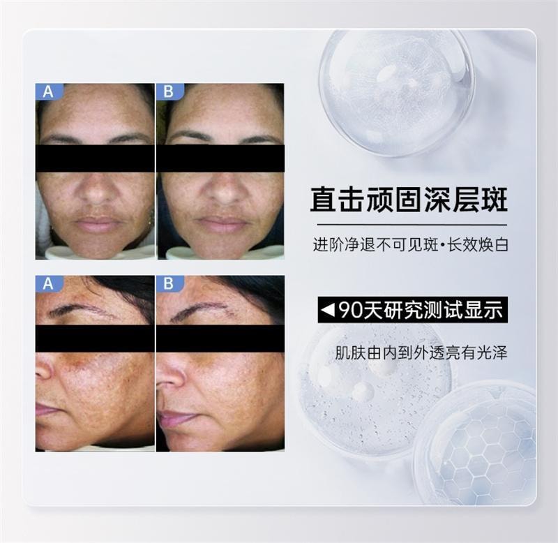 【中国直邮】 碧维斯 打斑美白丸 全身美白淡纹祛斑谷胱甘肽葡萄籽褪黑丸 40粒/盒