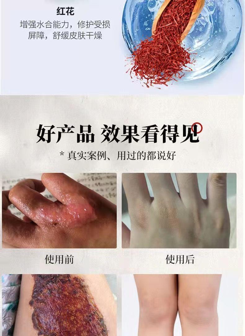  祥醫堂 獾油燙傷膏15g/盒 修護肌膚、止痛消腫、溫和舒緩、燙傷燒傷疤痕膏