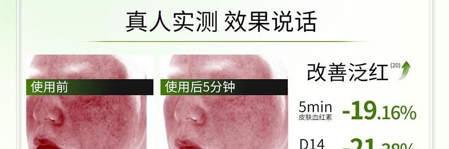VOOLGA敷尔佳 方胖子妆前湿敷棉片 酵能水盈湿敷膜 70片 替换装 #绿色 急救补水 舒缓修护 干皮干燥缺水肌 敏感肌适用