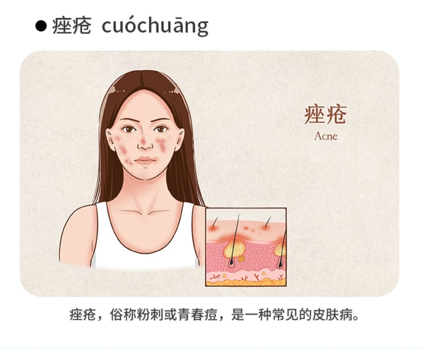 【中国直邮】仁和 阿达帕林凝胶 祛痘痘消炎维a酸乳膏 20g/支 (医师建议拍3盒)