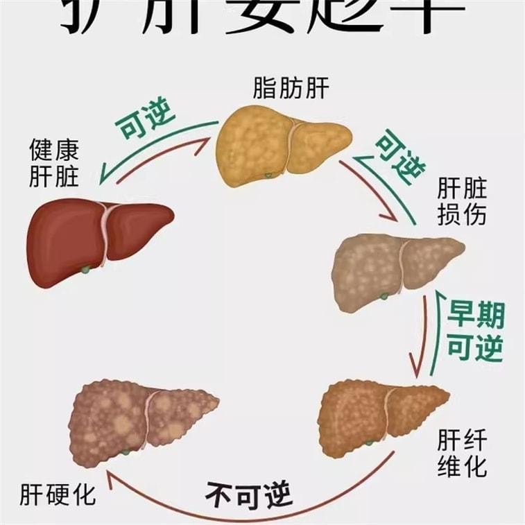 【中国直邮】 维特健灵 健肝宝 理肝气 养肝血 调肝火 缓解应酬养护熬夜肝解喝酒疲劳加班 60粒/盒