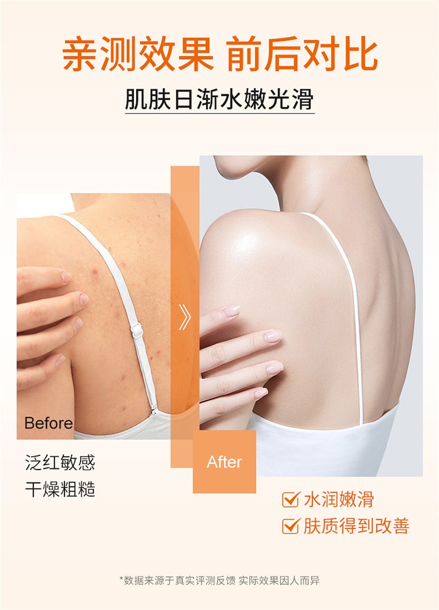 【中國直郵】肌膚之食 除蟎沐浴露背部去蟎蟲控油持久留香男女可用祛痘沐浴液 500ml/瓶