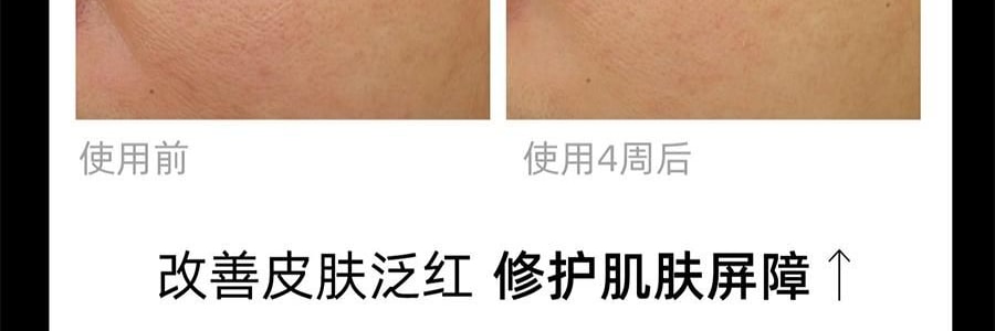 QUASARMD科施佳 黑金美容仪 LED光子嫩肤 红光脸部大排灯 家用美容仪 焕亮淡纹 紧致修护【抗皱紧致】
