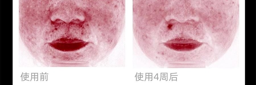 QUASARMD科施佳 黑金美容仪 LED光子嫩肤 红光脸部大排灯 家用美容仪 焕亮淡纹 紧致修护【抗皱紧致】