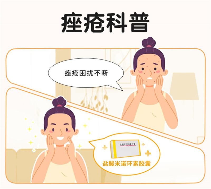 【中国直邮】 美满 盐酸米诺环素 胶囊痤疮 毛囊炎 抗菌消炎 20粒