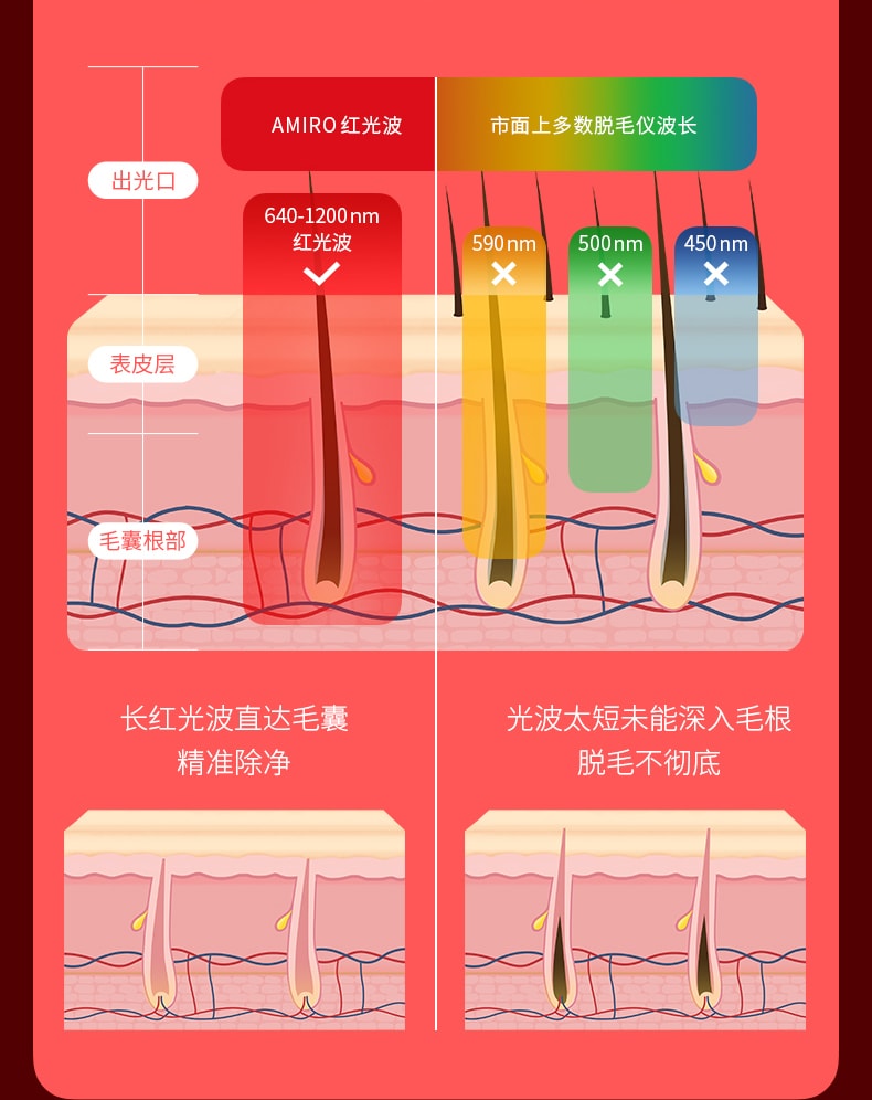 【返校季促销】中国直邮AMIRO觅光A2红光波脱毛仪冰点无痛脱毛唇毛腋毛全身家用