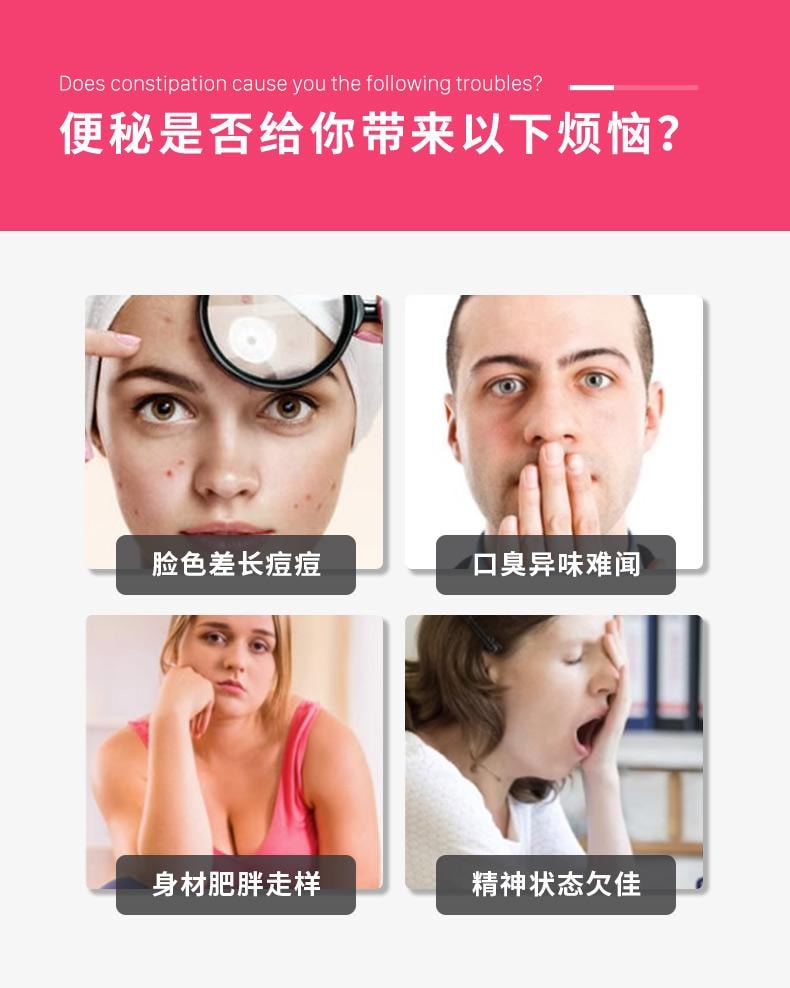 日本 KOKANDO皇汉堂 皇汉堂 便秘药 便秘丸 治疗剂 400粒