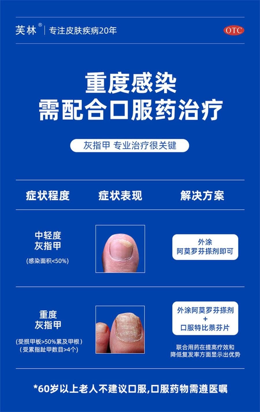 【中國直郵】 芙林 鹽酸阿莫羅芬搽劑 阿莫羅芬擦劑治灰指甲 強滲透 殺菌抑菌 1ml/盒