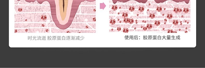 【中国直邮】卡蕾兰 RF射频美容家用脸部导入仪器面部洁面光子嫩肤提拉紧致童颜机去法令纹神器 紫色