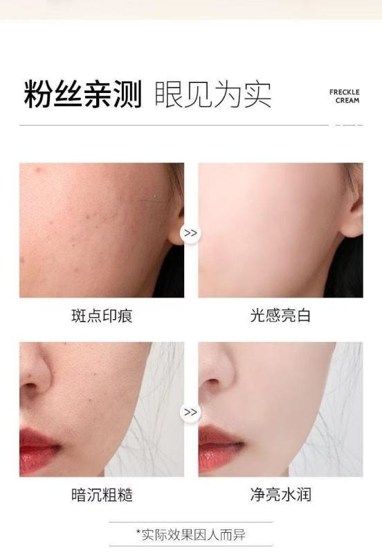 【中國直郵】 泊蝶 煙醯胺美白祛斑霜 淡斑去老年斑色斑雀斑保濕面霜乳 20g