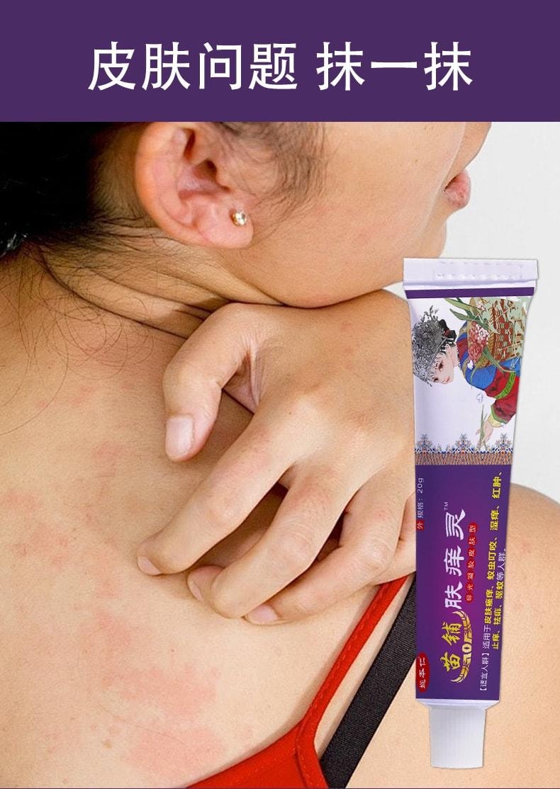 【中國直郵】 姚本仁 苗鋪膚癢靈 皮膚搔癢濕癢止癢外用軟膏乳膏 20g/盒