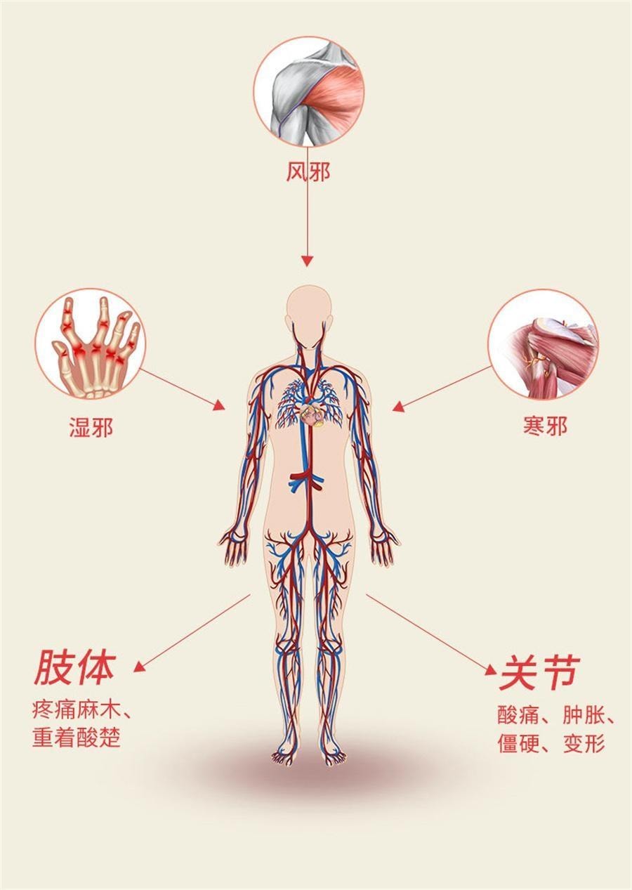 【中国直邮】 中国药材 黑骨藤追风活络胶囊 通络止痛 用于风湿腰腿疼祛风湿 72粒/盒
